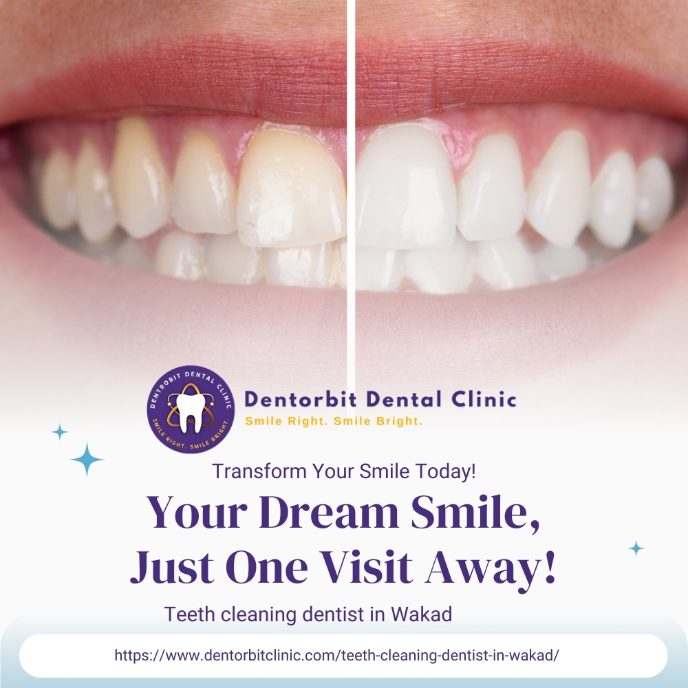Teeth cleaning dentist in Wakad